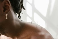 Acupuntura é oficialmente regulamentada como profissão no Brasil