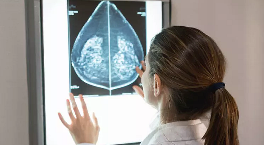 Casos de câncer de mama entre mulheres jovens mais que dobra no Brasil; veja explicações