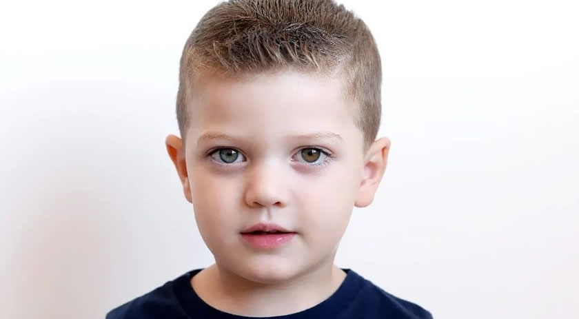 Heterocromia: a condição que deixa os olhos coloridos