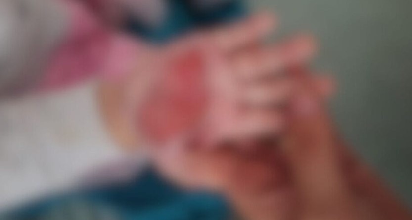 Madrasta choca com crueldade contra criança de apenas dois anos em Itajaí