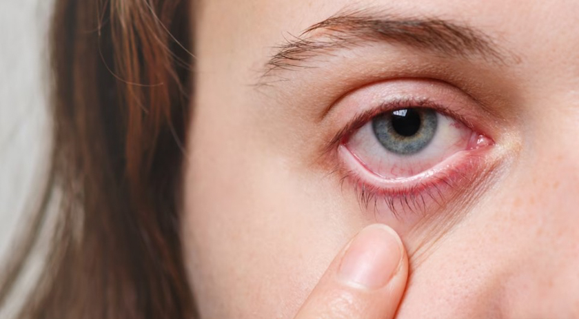 Sem sintomas iniciais, doença caracterizada por aumento da pressão nos olhos pode levar à cegueira