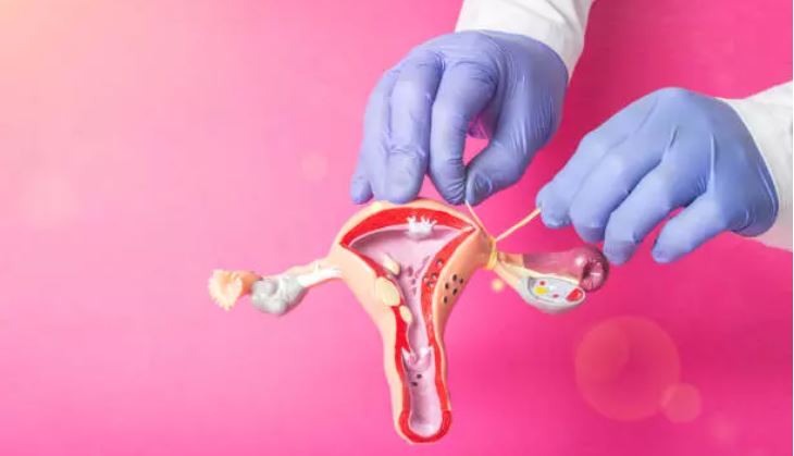 Laqueaduras em SC: cinco meses após a alteração da lei, esterilização feminina aumenta em 51%