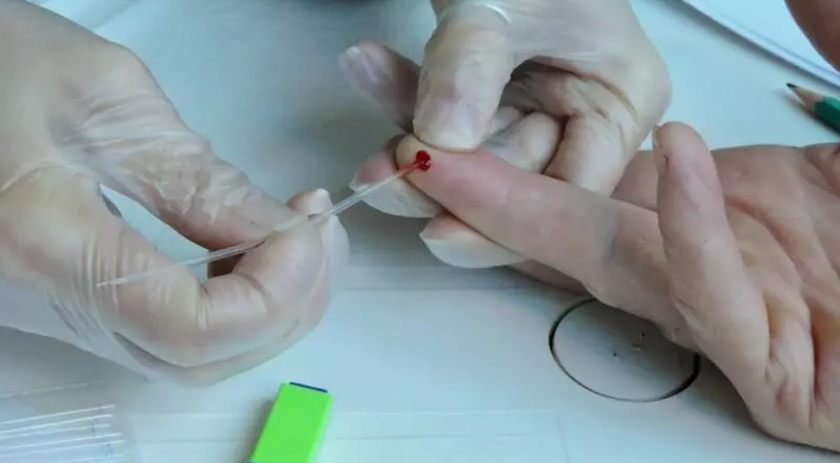 Mais de 23 mil pessoas foram diagnosticadas com hepatite em SC