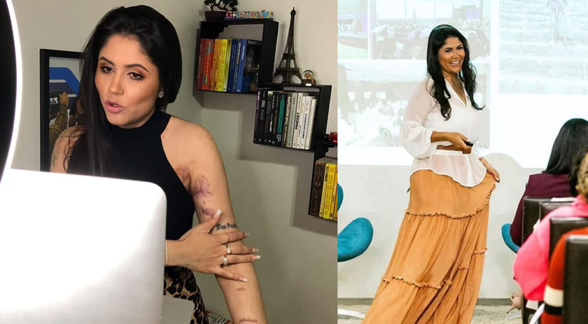 Mulher que sofreu descarga elétrica de 10 mil volts em Chapecó fala sobre superação