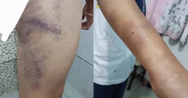 Homem é preso por agredir filho de 9 anos com pedaço de madeira