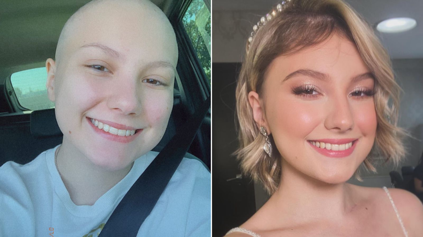 Isabel Veloso é internada na UTI após parada respiratória; excesso de magnésio é apontado como causa