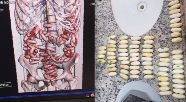 Duas pessoas são presas no Aeroporto do Recife com 214 cápsulas de cocaína no estômago
