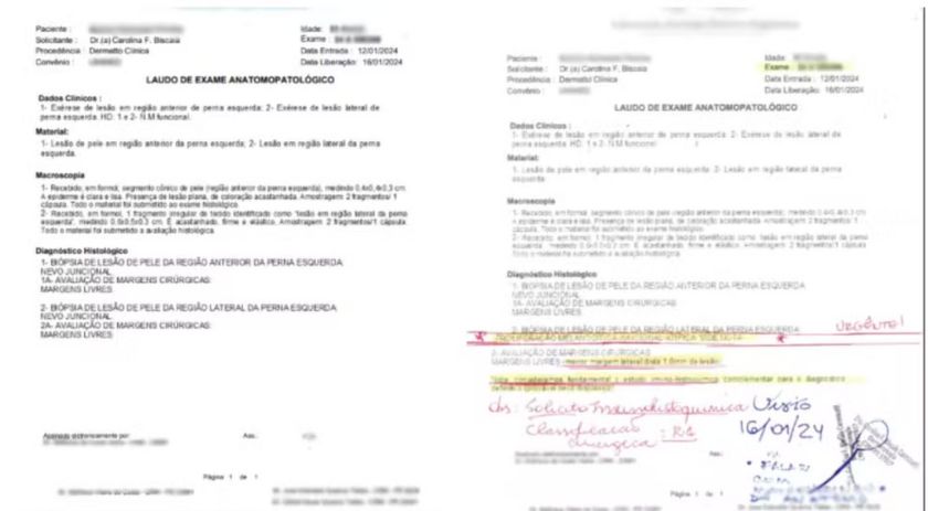 Laudos falsos de câncer usados por médica suspeita de fraudar diagnósticos eram feitos em máquina de xerox, diz delegado