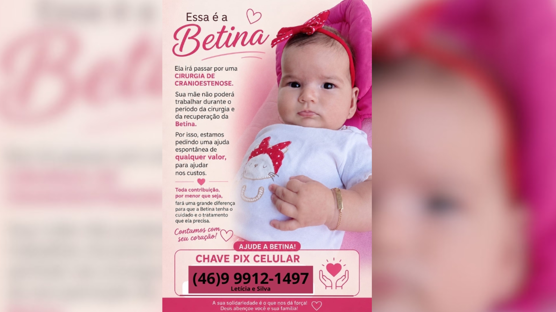 Família faz campanha para ajudar Betina em cirurgia de cranioestenose