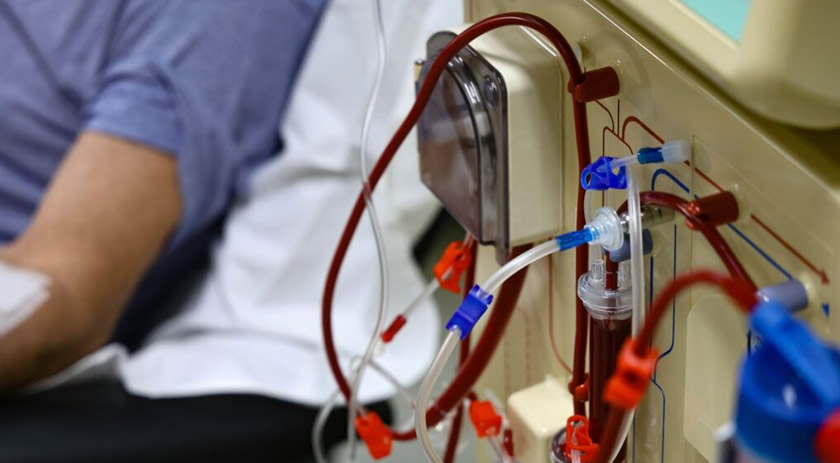 ​Estado amplia investimentos para melhorar tratamento a pacientes renais em SC