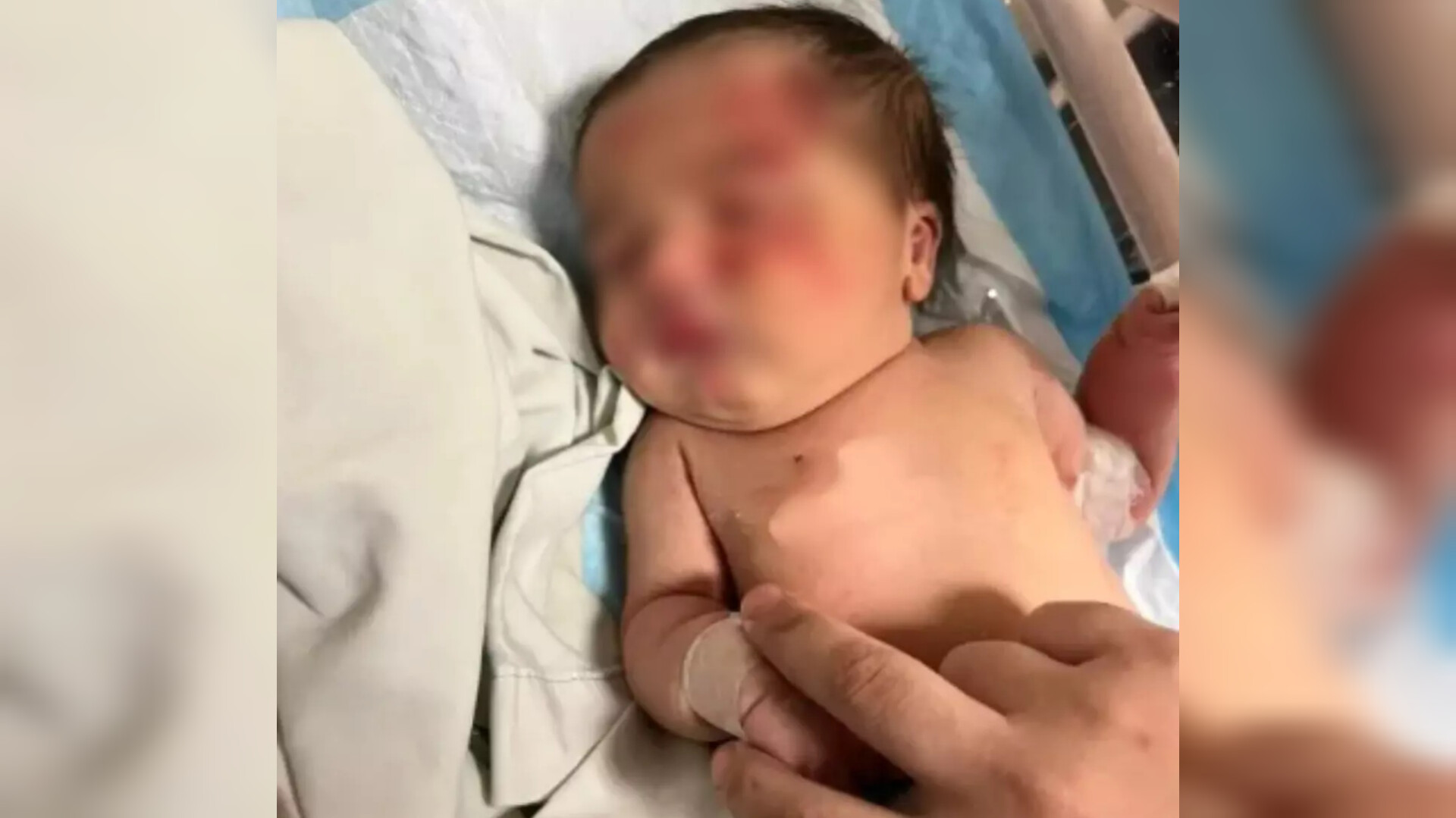 Bebê é abandonado em lixo e é salvo por cachorro de rua