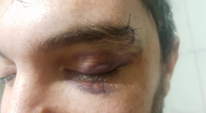 Jovem detalha agressão sofrida em Jaraguá do Sul: ‘vi a raiva nos olhos dele’