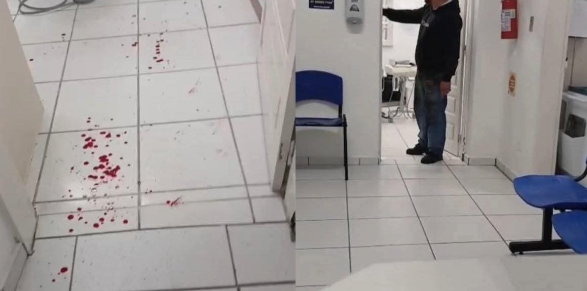 Criança sai sangrando de consulta e pai parte pra cima de dentista