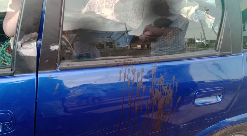 Família é baleada após entrar em propriedade rural por engano; idosa perdeu um dedo