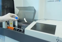 Exame de sangue para identificar Alzheimer chega ao Brasil e custa cerca de R$ 3 mil
