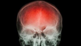 A cada 40 segundos, alguém sofre um AVC. Saber como reagir pode fazer a diferença.