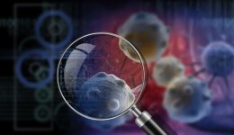 Estudo explica por que alguns tumores de mama resistem ao tratamento