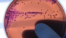 Abuso de antimicrobianos na pandemia pode ter agravado resistência a bactérias, aponta estudo