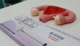 Mulheres podem ter acesso ao DIU de forma gratuita através do SUS