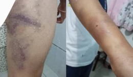 Homem é preso por agredir filho de 9 anos com pedaço de madeira