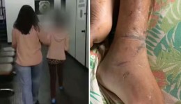 Filho acorrentado pela mãe ficava dias sem comer, sem beber água e vivia situações de extremo sofrimento, diz delegada