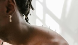 Acupuntura é oficialmente regulamentada como profissão no Brasil