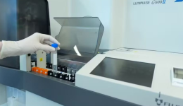 Exame de sangue para identificar Alzheimer chega ao Brasil e custa cerca de R$ 3 mil