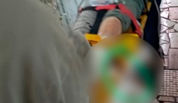 Idosa sofre queda e tem perna transfixada por vergalhão