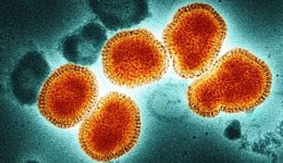 SC confirma 17 casos de variação da Influenza A (H3N2), conhecida como Gripe K