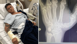 Popó faz cirurgia após briga generalizada em luta com Wanderlei Silva