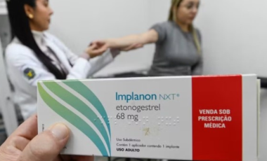 Implante contraceptivo deve ser ofertado por planos a partir de hoje