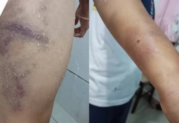 Homem é preso por agredir filho de 9 anos com pedaço de madeira