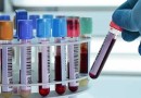Exame de sangue que rastreia Alzheimer pode virar real, diz estudo