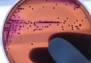 Abuso de antimicrobianos na pandemia pode ter agravado resistência a bactérias, aponta estudo