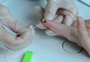 Mais de 23 mil pessoas foram diagnosticadas com hepatite em SC