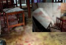 Homem ferido a golpes de facão tem dois dedos amputados