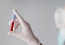Novo exame de sangue é promessa para detectar câncer de cólon