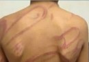 Mãe é presa após agredir filho de 12 anos com chicote