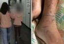 Filho acorrentado pela mãe ficava dias sem comer, sem beber água e vivia situações de extremo sofrimento, diz delegada