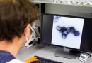 Primeiro caso de varíola do macaco na América do Sul é confirmado na Argentina