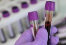 Alerta para o diagnóstico precoce de anemia e leucemia, doenças ligadas ao sangue