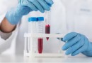 Cientistas descobrem proteínas que podem detectar câncer 7 anos antes do diagnóstico