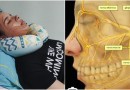 Ação entre amigos tenta ajudar jovem que sofre de Neuralgia do Trigêmeo