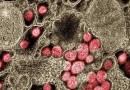Santa Catarina confirma primeiro caso da variante Ômicron