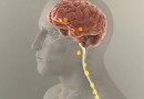 Como funciona implante para tratar depressão resistente que será aplicado pela 1ª vez no Brasil