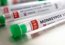 SC monitora segundo paciente com suspeita de varíola dos macacos
