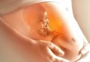 Cirurgia feita dentro do útero da mãe salva vida de bebê com tumor no pulmão