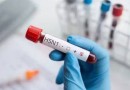 Brasil tem novos casos de gripe aviária e número de focos sobe para 64