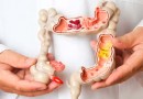 SC terá cerca de 2,5 mil novos casos de câncer de intestino em 2023, prevê Inca
