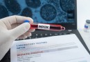 Casos de mpox no Brasil chegam a 945 e já superam o total de 2023